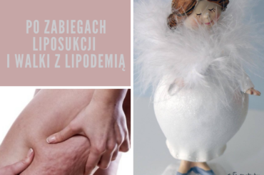 Aesthetic physiotherapy treatments after LIPOSUCTION and fighting LIPODEMIA